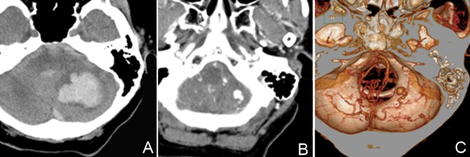 Figure 1