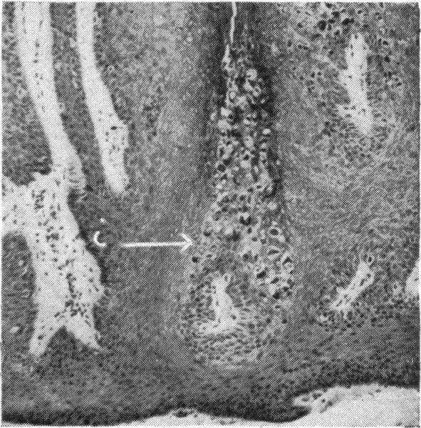 Fig. 11