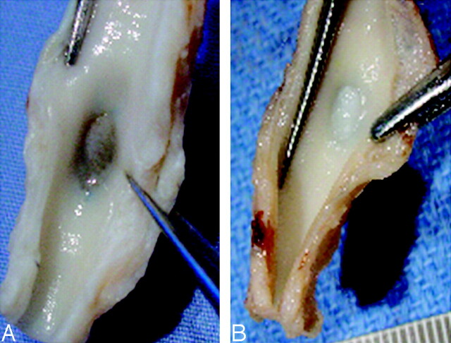 Fig 2.