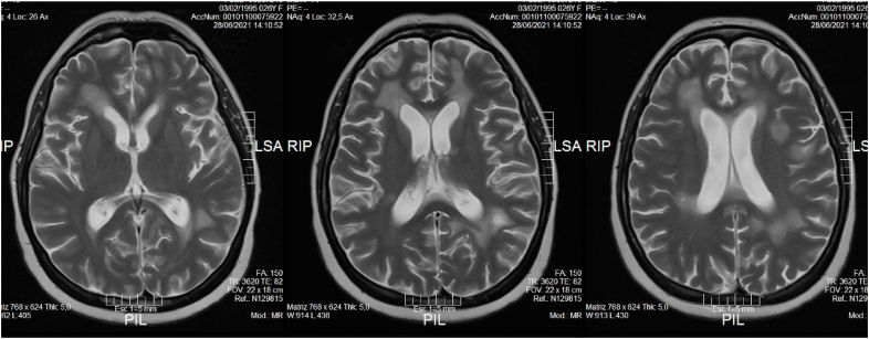 Fig. 3