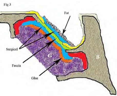 
Fig.3
