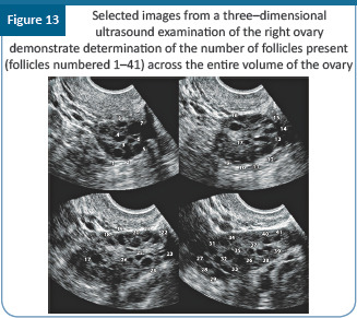 graphic file with name JHRS-17-1-g020.jpg