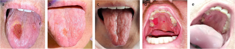 FIG 1
