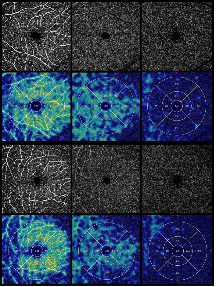 Fig. 2