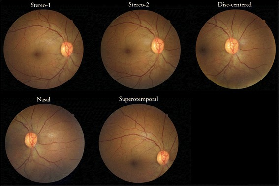 Fig. 1