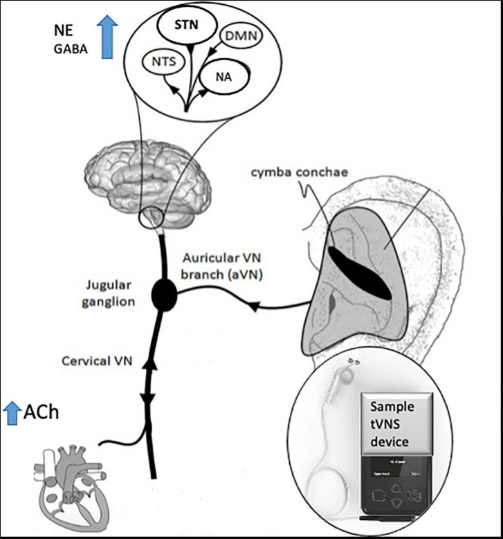 FIGURE 2