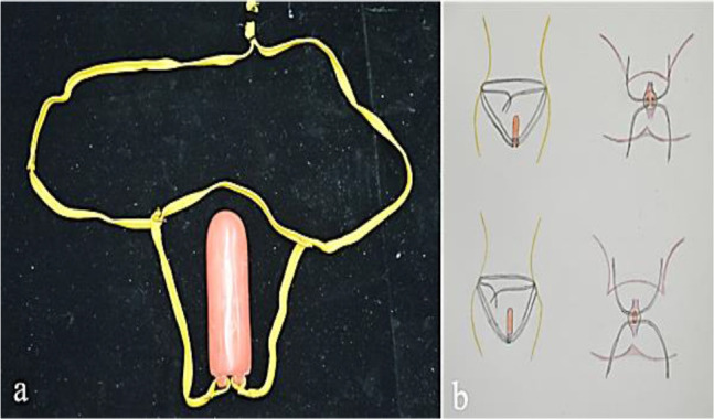 Figure 2: