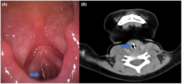 FIGURE 1