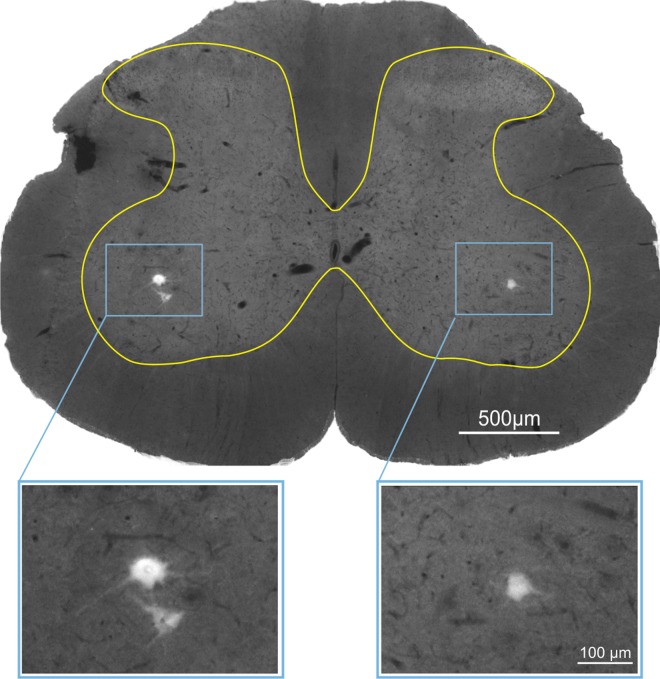 Fig 1