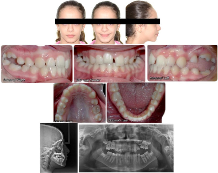 FIGURE 2