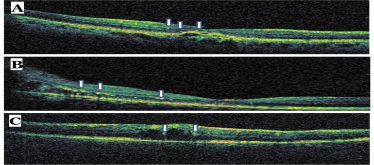 Fig. (3)