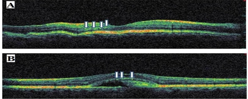 Fig. (5)