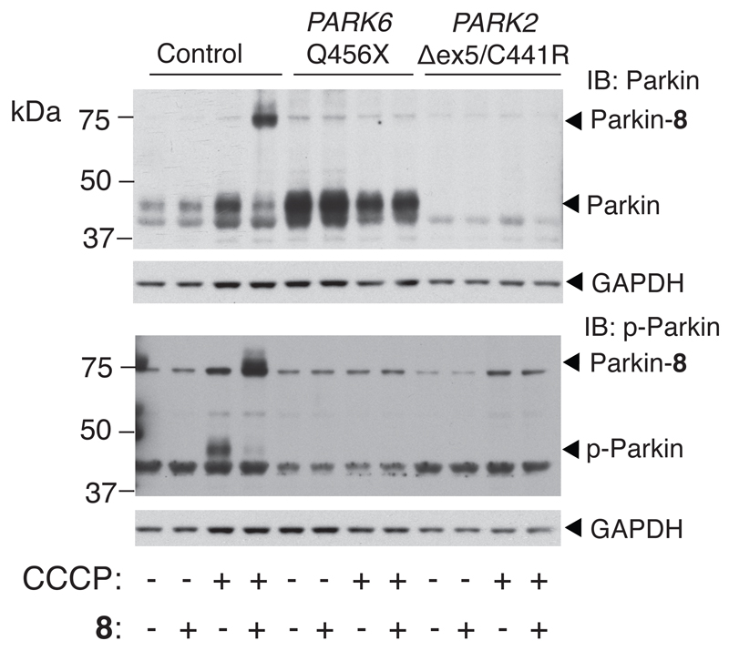 Probes of Ubiquitin E3 ligases distinguish different stages of Parkin ...