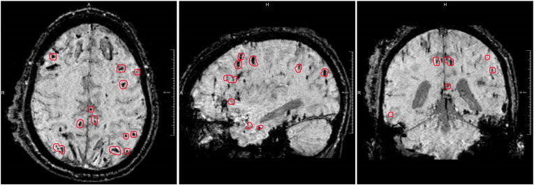 Fig. 2