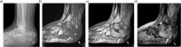 Fig. 9