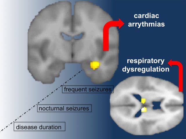 graphic file with name awv233fig1g.jpg