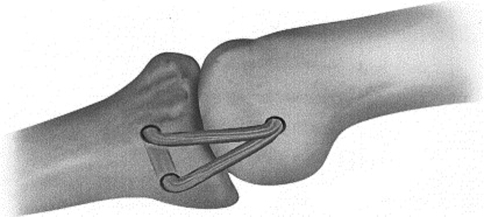 Fig. 8