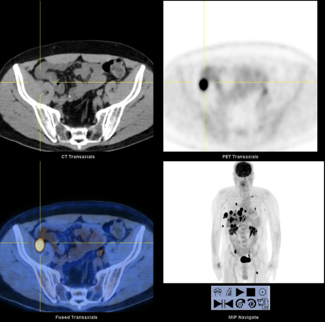 FIG. 2.