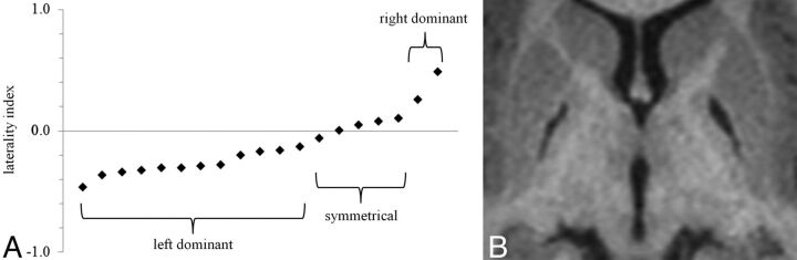 Fig 2.