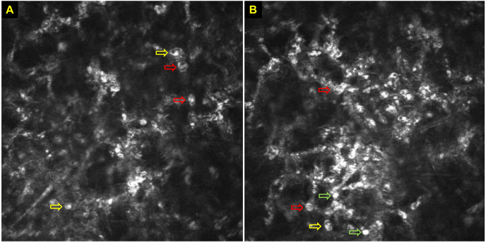 Fig. 4