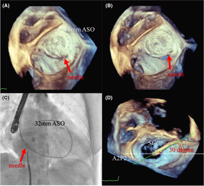 FIGURE 3