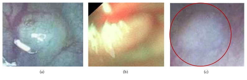 Figure 11