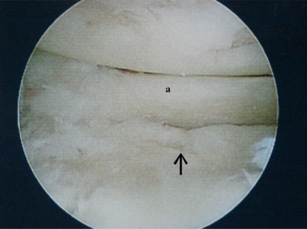 Fig. (2a)