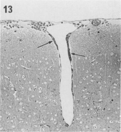 Fig. 13