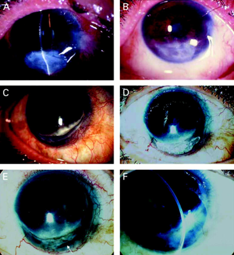 Figure 2  