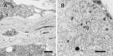 Fig. 11.