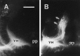 Fig. 16.