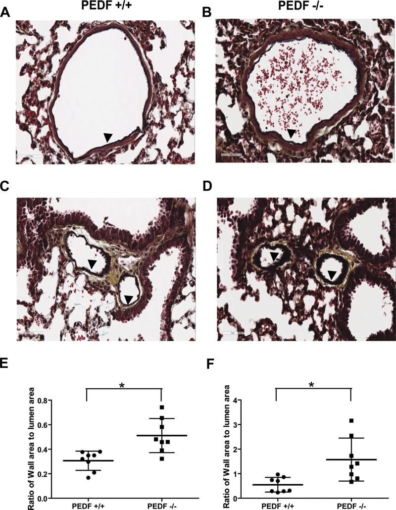 Fig. 14.