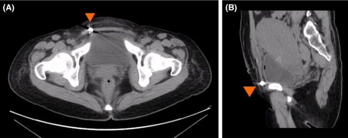 FIGURE 2