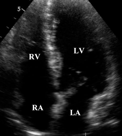 Fig. 4