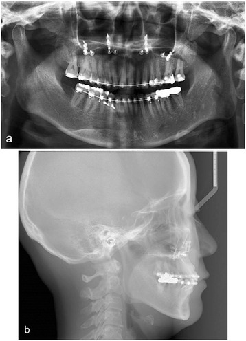 Fig. 8