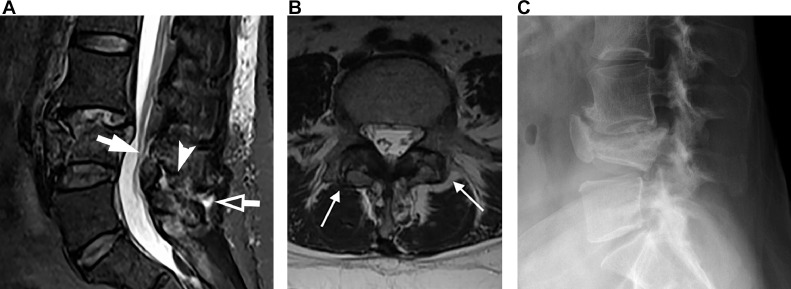 Fig 4