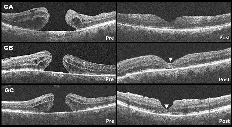 Fig. 2