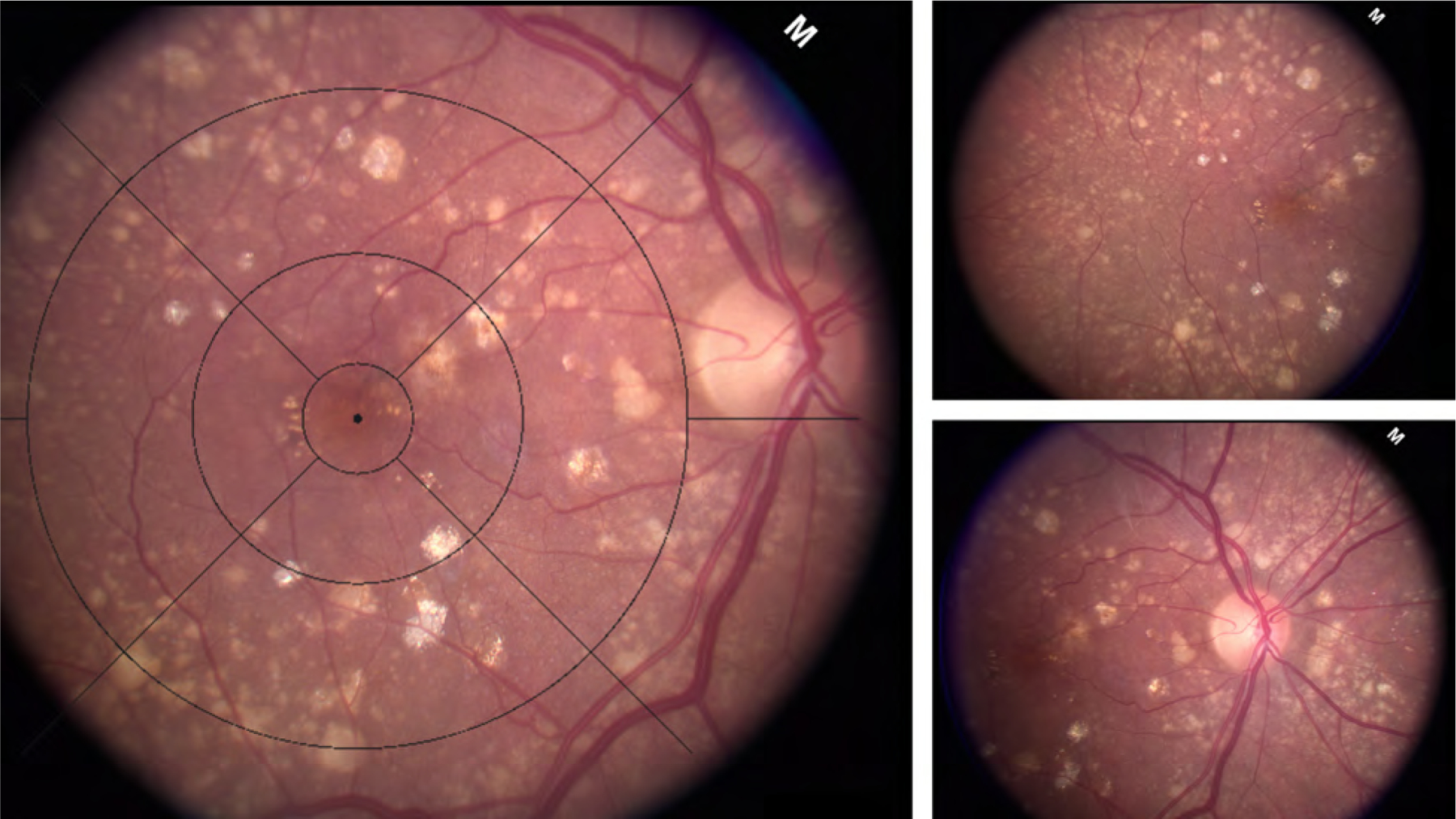 Figure 1: