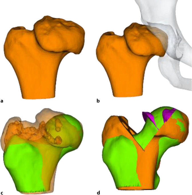 graphic file with name 64_2022_779_Fig1_HTML.jpg