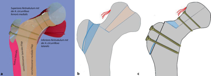 graphic file with name 64_2022_779_Fig20_HTML.jpg