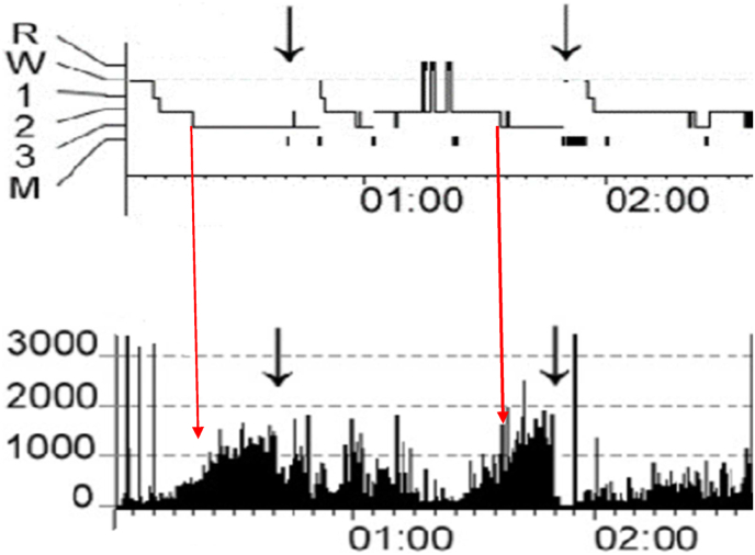 Fig. 2