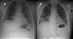 FIG 1