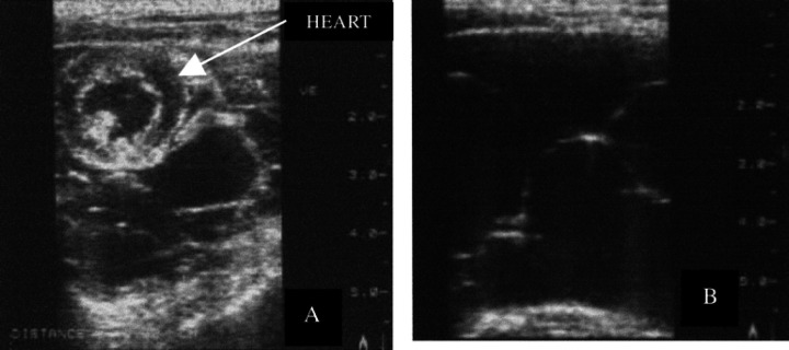 Fig 2.