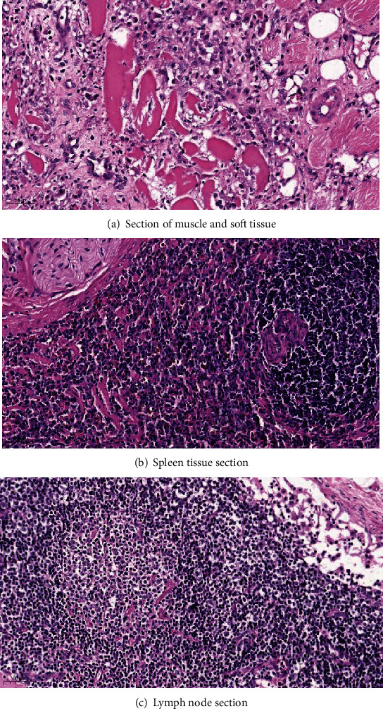 Figure 14