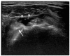 Fig. 9.