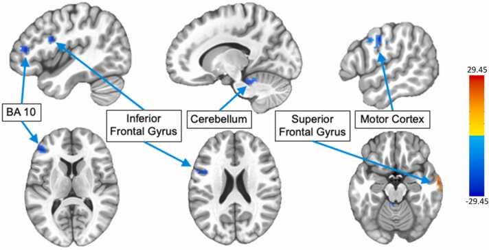 Fig. 10