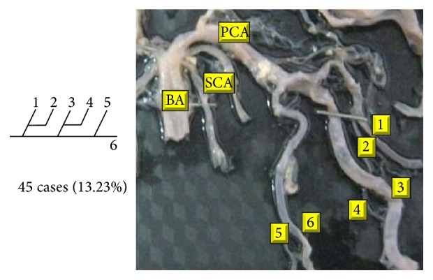 Figure 26