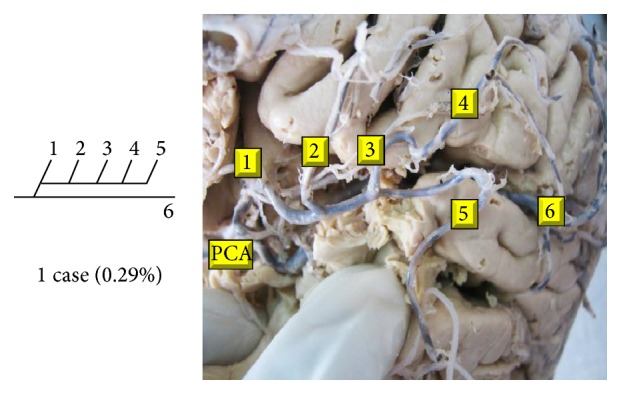 Figure 25