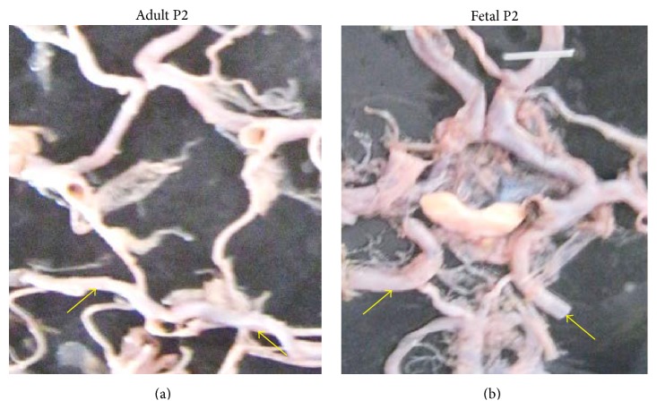 Figure 13