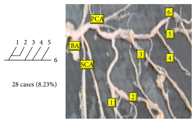 Figure 16